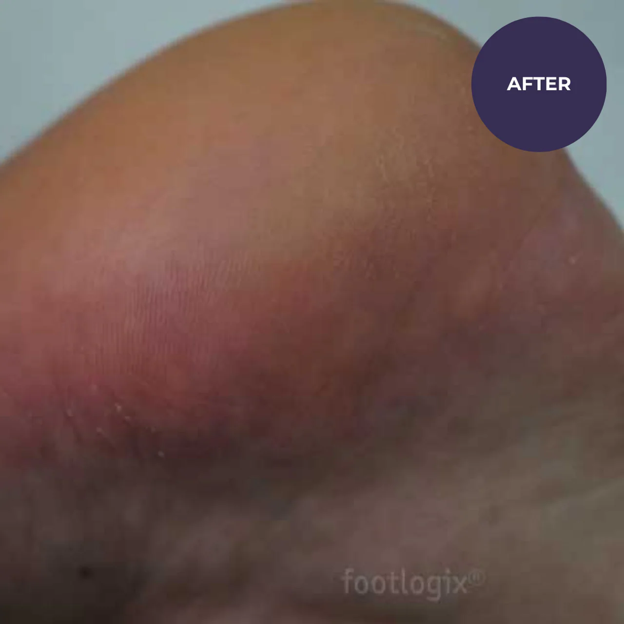 Footlogix DD Cream Mousse Formula (125ml) - Image 5