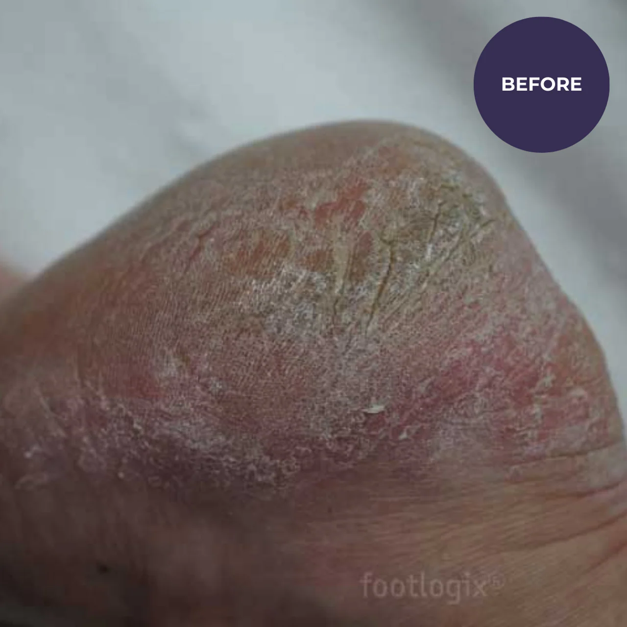 Footlogix DD Cream Mousse Formula (125ml) - Image 6