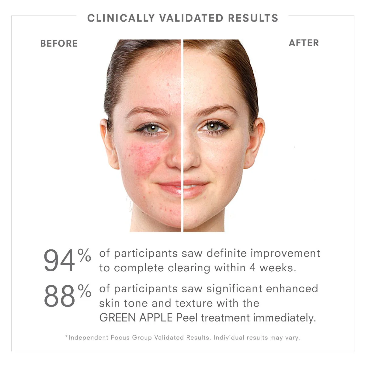 Juice Beauty BLEMISH CLEARING Solutions (£77 RRP) - Image 3