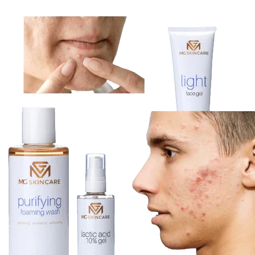 MG Skincare - PURIFYING FACE TONER - Image 2