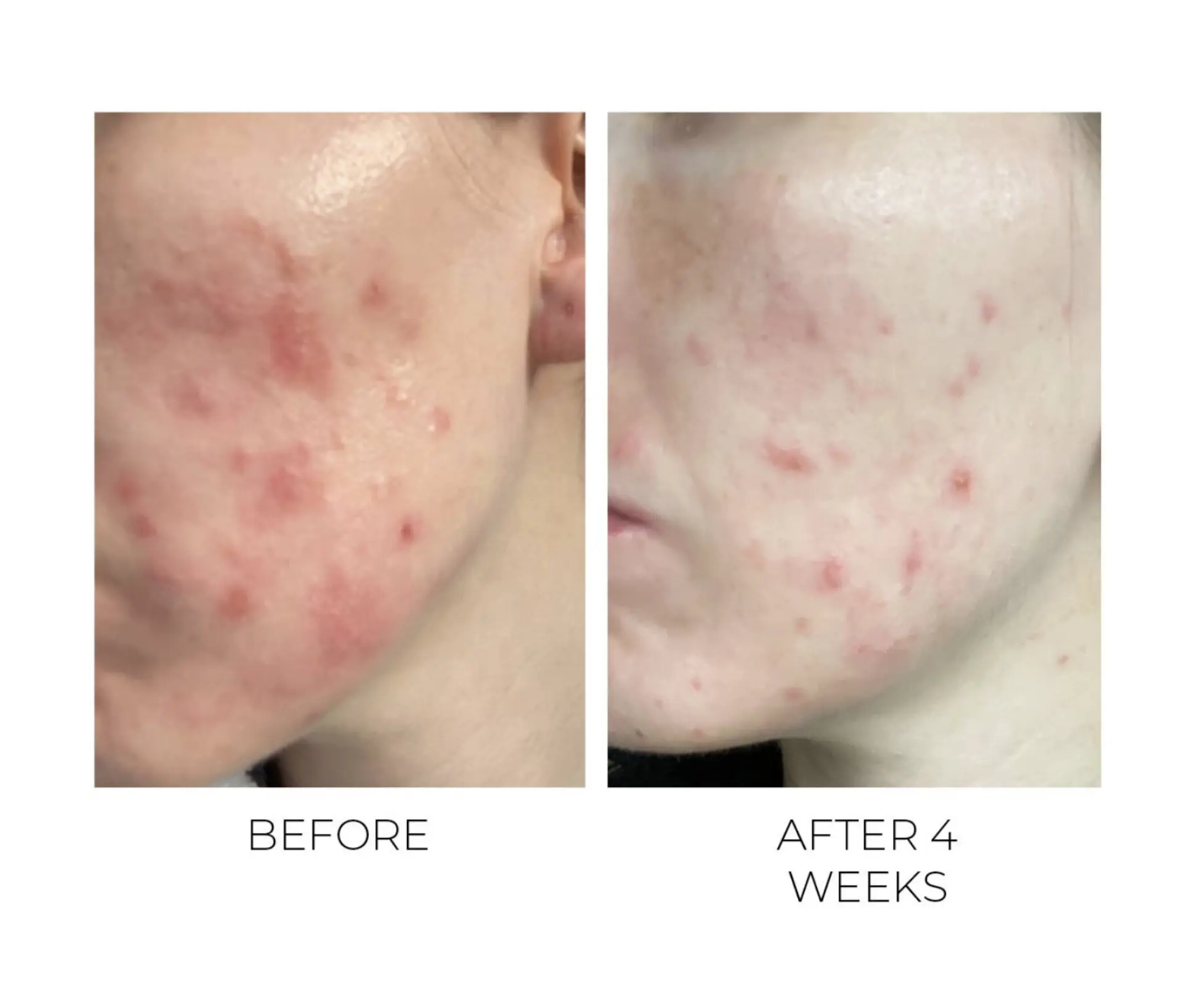 Oskia Violet Water BHA Clarifying Treatment Tonic 100ml. - Image 3