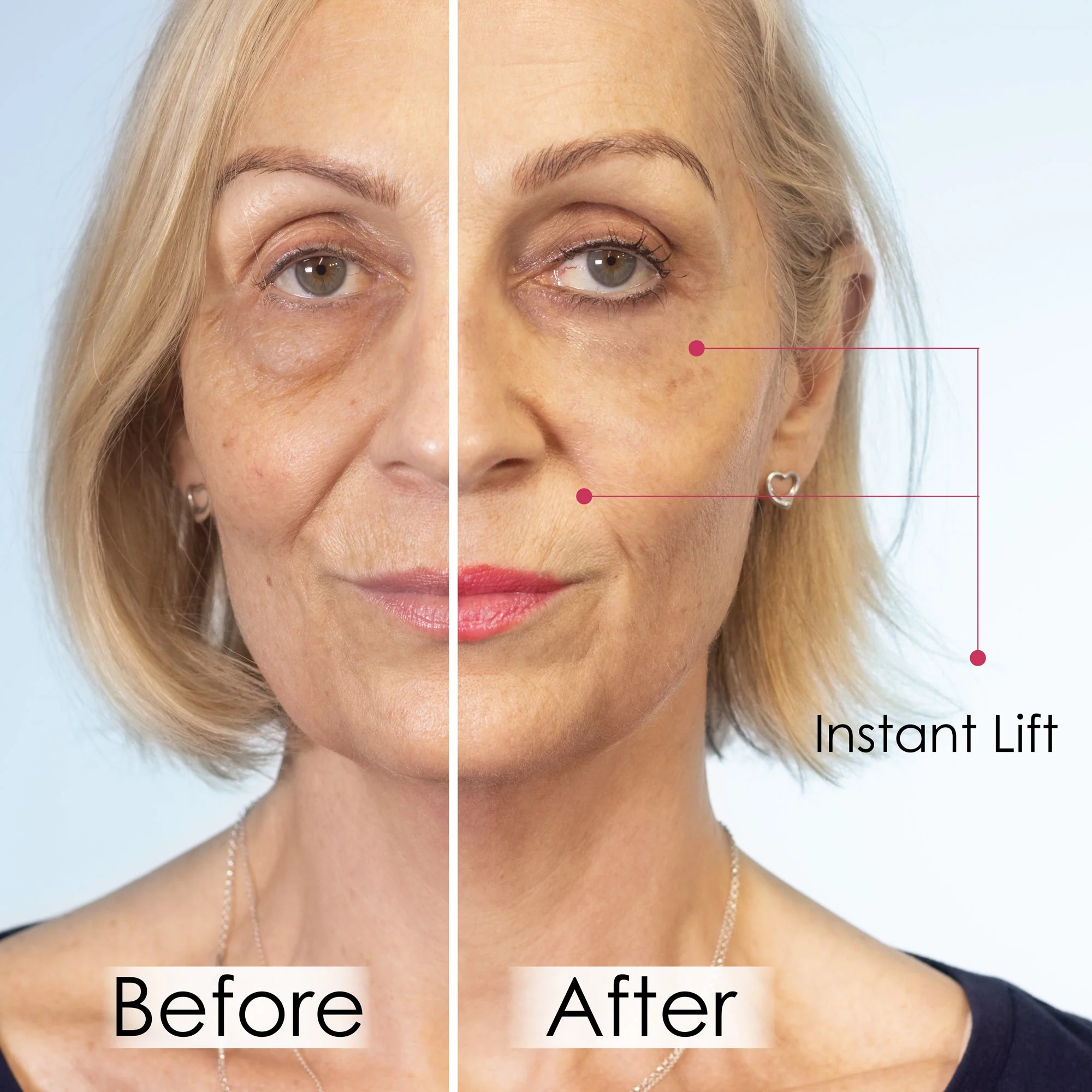 skinChemists Wrinkle Killer Instant Lift with Hyaluronic Acid & Peptides - Image 2